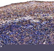 IHC staining of FFPE human tonsil tissue with IL7RA antibody, HRP-secondary and DAB substrate. HIER: boil tissue sections in pH8 EDTA for 20 min and allow to cool before testing.