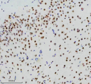 IHC staining of FFPE mouse brain tissue with Cyclin dependent kinase 9 antibody, HRP-secondary and DAB substrate. HIER: boil tissue sections in pH8 EDTA for 20 min and allow to cool before testing.
