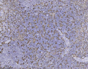 AIF-1 Antibody Rabbit Monoclonal Tonsil IHC. Immunohistochemistry of AIF-1 Antibody Rabbit Monoclonal clone AFGH-1 in human tonsil tissue. Formalin-fixed, paraffin-embedded tonsil demonstrates cytoplasmic HRP-DAB brown staining in scattered immune cells within the lymphoid parenchyma, consistent with Allograft inflammatory factor 1 expression in macrophages and activated immune cells. Heat-induced epitope retrieval was performed by boiling tissue sections in pH 8 EDTA for 20 minutes followed by cooling prior to staining. The rabbit monoclonal antibody clone AFGH-1 was used as the primary antibody, with HRP-conjugated secondary antibody and DAB substrate for chromogenic detection.