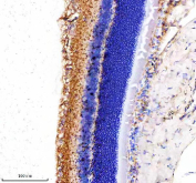 IHC staining of FFPE rat eye tissue with MYO7A antibody, HRP-secondary and DAB substrate. HIER: boil tissue sections in pH8 EDTA for 20 min and allow to cool before testing.