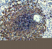 CD22 Antibody Spleen Tissue IHC Staining. Immunohistochemistry analysis of CD22/Siglec-2 expression in FFPE human spleen tissue using CD22 Antibody / B Cell Internalization and Targeting Antibody. HRP-DAB brown staining is concentrated within lymphoid follicles of the white pulp, highlighting dense populations of B lymphocytes with prominent membranous and cytoplasmic localization, while surrounding red pulp regions and non-lymphoid elements remain largely negative. The staining pattern is consistent with CD22 surface expression and its role in receptor internalization and cellular targeting within B cell compartments. Detection was performed using an HRP-conjugated secondary antibody with DAB substrate. Heat-induced epitope retrieval was carried out in pH 8 EDTA buffer for 20 minutes followed by cooling prior to antibody incubation.