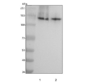 CD22 Antibody for WB. Western blot analysis of CD22/Siglec-2 expression using CD22 Antibody / B Cell Internalization and Targeting Antibody in human B cell lymphoma lysates. Lane 1: Raji lysate, Lane 2: Ramos lysate. A band is detected at approximately 130-150 kDa, consistent with the predicted molecular weight of CD22 / CD22 and reflecting its glycosylated form, while potential lower molecular weight species may represent less modified forms of the protein. The banding pattern aligns with the known expression of CD22 in B cell-derived lines and supports its use for western blot analysis of receptor expression and internalization-associated protein processing.