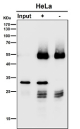 Immunoprecipitation of CHMP2B protein from 500ug of human HeLa whole cell lysate using CHMP2B antibody at 1:50 (Western blot testing done at 1:3000).