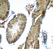 IHC staining of FFPE mouse testis tissue with DEAD box protein 1 antibody, HRP-secondary and DAB substrate. HIER: boil tissue sections in pH8 EDTA for 20 min and allow to cool before testing.
