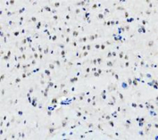 IHC staining of FFPE mouse brain tissue with DEAD box protein 1 antibody, HRP-secondary and DAB substrate. HIER: boil tissue sections in pH8 EDTA for 20 min and allow to cool before testing.