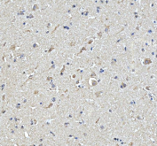 IHC staining of FFPE human brain tissue with STON2 antibody, HRP-secondary and DAB substrate. HIER: boil tissue sections in pH8 EDTA for 20 min and allow to cool before testing.