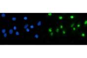 Immunofluorescent staining of FFPE human A549 cells with USP5 antibody (green) and DAPI nuclear stain (blue). HIER: steam section in pH6 citrate buffer for 20 min.
