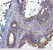 IHC staining of FFPE human ovarian tissue with SOCS5 antibody, HRP-secondary and DAB substrate. HIER: boil tissue sections in pH8 EDTA for 20 min and allow to cool before testing.