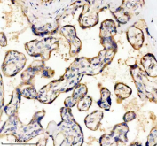 IHC analysis of CD39 Antibody in FFPE human placental tissue. The antibody for research demonstrates membranous and apical HRP-DAB brown staining in trophoblastic cells lining chorionic villi, consistent with CD39 expression, while surrounding stromal elements show minimal staining. Heat-induced epitope retrieval was performed in pH 8 EDTA buffer for 20 minutes followed by cooling prior to testing.
