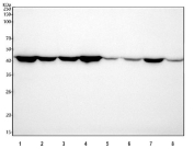Western blot testing of human 1) A549, 2) HeLa, 3) 293T, 4) HepG2, 5) Caco-2, 6) SH-SY5Y, 7) U-251 and 8) MCF7 cell lysate using ACTA2 antibody. Predicted molecular weight ~42 kDa.