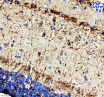 Zebrafish ILK Antibody Brain IHC. Immunohistochemistry staining of FFPE zebrafish brain tissue with Zebrafish ILK antibody. HIER: boil tissue sections in pH8 EDTA for 20 min and allow to cool before testing.