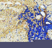 Zebrafish Actin-related protein 2 Antibody Brain IHC. Immunohistochemistry staining of FFPE zebrafish brain tissue with Zebrafish Actin-related protein 2 antibody. HIER: boil tissue sections in pH8 EDTA for 20 min and allow to cool before testing.