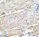 Zebrafish Actin-related protein 2 Antibody Skeletal Muscle IHC. Immunohistochemistry staining of FFPE zebrafish skeletal muscle tissue with Zebrafish Actin-related protein 2 antibody. HIER: boil tissue sections in pH8 EDTA for 20 min and allow to cool before testing.