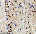 Zebrafish Hnrnpd Antibody Cerebellum IHC. Immunohistochemistry staining of FFPE zebrafish cerebellum tissue with Zebrafish Hnrnpd antibody. HIER: boil tissue sections in pH8 EDTA for 20 min and allow to cool before testing.
