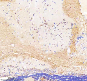 Zebrafish Bap1 Antibody Brain Tissue IHC. Immunohistochemical analysis of Bap1 protein using Zebrafish Bap1 antibody and paraffin-embedded zebrafish brain tissue. HIER: boil tissue sections in pH8 EDTA for 20 min and allow to cool before testing.