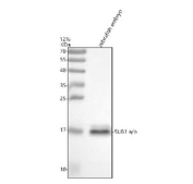Zebrafish Sub1 Antibody WB. Western blot analysis of Sub1a/b protein using Sub1 antibody and zebrafish embryo tissue lysate. The predicted molecular weight of Sub1a/b is 14 kDa.