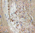 Zebrafish Eif4a1 Antibody Brain IHC. Immunohistochemistry staining of FFPE zebrafish brain tissue with Zebrafish Eif4a1 antibody. HIER: boil tissue sections in pH8 EDTA for 20 min and allow to cool before testing.
