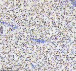 Zebrafish Ppp2ca Antibody Liver IHC. Immunohistochemistry staining of FFPE zebrafish liver tissue with Ppp2ca antibody, HRP secondary and DAB substrate. HIER: boil tissue sections in pH8 EDTA for 20 min and allow to cool before testing.