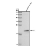 Zebrafish Ptp4a2 Antibody WB. Western blot analysis of Ptp4a2 protein using Zebrafish Ptp4a2 antibody and zebrafish embryo tissue lysate. The predicted molecular weight of Ptp4a2 is ~19 kDa.
