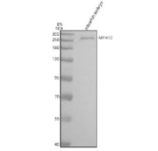 Zebrafish Myosin 10 Antibody WB. Western blot analysis of MYH10 protein using Myosin 10 antibody and zebrafish embryo tissue lysate. The predicted molecular weight of Myosin 10 is ~229 kDa.