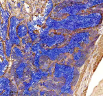 Zebrafish Gipc1 Antibody Testis IHC. Immunohistochemistry staining of FFPE zebrafish testis tissue with Zebrafish Gipc1 antibody. HIER: boil tissue sections in pH8 EDTA for 20 min and allow to cool before testing.