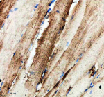 Zebrafish Hprt1 Antibody Muscle Tissue IHC. Immunohistochemistry staining of FFPE zebrafish muscle tissue with Zebrafish Hprt1 antibody. HIER: boil tissue sections in pH8 EDTA for 20 min and allow to cool before testing.