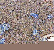 Zebrafish Hprt1 Antibody Liver Tissue IHC. Immunohistochemistry staining of FFPE zebrafish liver tissue with Zebrafish Hprt1 antibody. HIER: boil tissue sections in pH8 EDTA for 20 min and allow to cool before testing.
