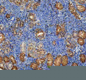 Zebrafish Abce1 Antibody Kidney IHC. Immunohistochemistry staining of FFPE zebrafish kidney tissue with Zebrafish Abce1 antibody, HRP-secondary and DAB substrate. HIER: boil tissue sections in pH8 EDTA for 20 min and allow to cool before testing.