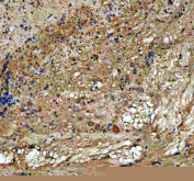 Zebrafish Abce1 Antibody Brain IHC. Immunohistochemistry staining of FFPE zebrafish brain tissue with Zebrafish Abce1 antibody. HIER: boil tissue sections in pH8 EDTA for 20 min and allow to cool before testing.