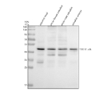 Zebrafish Tsg101 Antibody WB. Western blot analysis of TSG101a/b protein using Zebrafish Tsg101 antibody and 1) zebrafish head, 2) whole female zebrafish, 3) whole male zebrafish and 4) zebrafish embryo tissue lysate. Predicted molecular weight ~44 kDa.