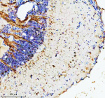 Hprt1 Antibody Brain IHC. Immunohistochemistry staining of FFPE zebrafish brain tissue with Zebrafish Hypoxanthine phosphoribosyltransferase antibody. HIER: boil tissue sections in pH8 EDTA for 20 min and allow to cool before testing.