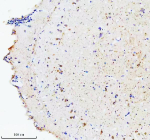 Zebrafish Hsc70 Antibody Brain IHC. Immunohistochemistry staining of FFPE zebrafish brain tissue with Zebrafish Hsc70 antibody, HRP secondary and DAB substrate. HIER: boil tissue sections in pH8 EDTA for 20 min and allow to cool before testing.
