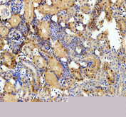 Zebrafish Csnk2b Antibody Kidney IHC. Immunohistochemistry staining of FFPE zebrafish kidney tissue with Zebrafish Csnk2b antibody, HRP secondary and DAB substrate. HIER: boil tissue sections in pH8 EDTA for 20 min and allow to cool before testing.