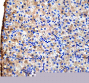 Zebrafish Vps53 Antibody Liver IHC. Immunohistochemical analysis of Vps53 protein using Vps53 antibody and paraffin-embedded zebrafish liver tissue. HIER: boil tissue sections in pH8 EDTA for 20 min and allow to cool before testing.