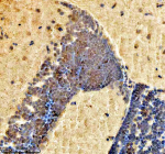 Zebrafish H2ax Antibody Brain Immunohistochemistry. IHC staining of FFPE zebrafish brain tissue with Zebrafish H2ax antibody, HRP secondary and DAB substrate. HIER: boil tissue sections in pH8 EDTA for 20 min and allow to cool before testing.