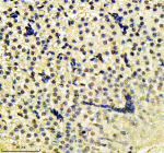 Zebrafish H2ax Antibody Liver IHC. Immunohistochemistry staining of FFPE zebrafish liver tissue with Zebrafish H2ax antibody, HRP secondary and DAB substrate. HIER: boil tissue sections in pH8 EDTA for 20 min and allow to cool before testing.