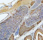 Zebrafish Atp6v1a Antibody Spleen IHC. Immunohistochemical analysis of Atp6v1a protein using Zebrafish Atp6v1a antibody and paraffin-embedded zebrafish spleen tissue. HIER: boil tissue sections in pH8 EDTA for 20 min and allow to cool before testing.