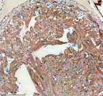 Zebrafish Fhl2 Antibody Heart IHC. Immunohistochemical analysis of FHL2a/b protein using Zebrafish Fhl2 antibody, HRP secondary and DAB substrate with paraffin-embedded zebrafish heart tissue. HIER: boil tissue sections in pH8 EDTA for 20 min and allow to cool before testing.