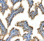 Zebrafish Mettl3 Antibody Colon Tissue IHC. Immunohistochemistry staining of Mettl3 protein using Zebrafish Mettl3 antibody, HRP secondary and DAB substrate with zebrafish colon tissue lysate. HIER: boil tissue sections in pH8 EDTA for 20 min and allow to cool before testing.