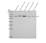 Zebrafish Kif3a Antibody Tissue WB. Western blot analysis of Kif3a protein using Zebrafish Kif3a antibody and 1) zebrafish head, 2) female zebrafish viscera, 3) male zebrafish viscera, 4) whole female zebrafish and 5) whole male zebrafish tissue lysate. Predicted molecular weight ~80 kDa commonly observed at 70-80 kDa.