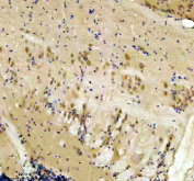 Zebrafish Dnaja2 Antibody Brain Tissue IHC. Immunohistochemical analysis of DNAJA2a/b protein using Zebrafish Dnaja2 antibody and paraffin-embedded zebrafish brain tissue. HIER: boil tissue sections in pH8 EDTA for 20 min and allow to cool before testing.