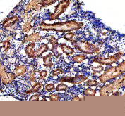Zebrafish Dlst Antibody Kidney Tissue IHC. Immunohistochemistry staining of FFPE zebrafish kidney tissue with Zebrafish Dlst antibody, HRP secondary and DAB substrate. HIER: boil tissue sections in pH8 EDTA for 20 min and allow to cool before testing.