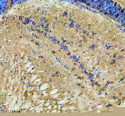 Zebrafish Dlst Antibody Brain Tissue IHC. Immunohistochemistry staining of FFPE zebrafish brain tissue with Zebrafish Dlst antibody, HRP secondary and DAB substrate. HIER: boil tissue sections in pH8 EDTA for 20 min and allow to cool before testing.