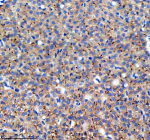 Zebrafish Dlst Antibody Liver Tissue IHC. Immunohistochemistry staining of FFPE zebrafish liver tissue with Zebrafish Dlst antibody, HRP secondary and DAB substrate. HIER: boil tissue sections in pH8 EDTA for 20 min and allow to cool before testing.