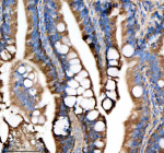 Zebrafish Dlst Antibody Colon Tissue IHC. Immunohistochemistry staining of FFPE zebrafish colon tissue with Zebrafish Dlst antibody, HRP secondary and DAB substrate. HIER: boil tissue sections in pH8 EDTA for 20 min and allow to cool before testing.