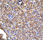 Zebrafish Ttc7b Antibody Liver Tissue IHC. Immunohistochemical analysis of Ttc7b protein using Zebrafish Ttc7b antibody, HRP secondary and DAB substrate with paraffin-embedded zebrafish liver tissue. HIER: boil tissue sections in pH8 EDTA for 20 min and allow to cool before testing.