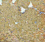 Zebrafish Hsp60 Antibody Heart Tissue IHC. Immunohistochemistry staining of FFPE zebrafish heart tissue with Zebrafish Hsp60 antibody, HRP secondary and DAB substrate. HIER: boil tissue sections in pH8 EDTA for 20 min and allow to cool before testing.