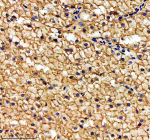 Zebrafish Hsp60 Antibody Liver Tissue IHC. Immunohistochemistry staining of FFPE zebrafish liver tissue with Zebrafish Hsp60 antibody, HRP secondary and DAB substrate. HIER: boil tissue sections in pH8 EDTA for 20 min and allow to cool before testing.