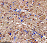 Zebrafish Gmps Antibody Brain Tissue IHC. Immunohistochemical analysis of Gmps protein using Zebrafish Gmps antibody and a paraffin-embedded zebrafish brain tissue. HIER: boil tissue sections in pH8 EDTA for 20 min and allow to cool before testing.