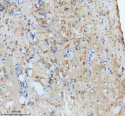 Zebrafish Cct4 Antibody Brain IHC. Immunohistochemistry staining of FFPE zebrafish brain tissue with Zebrafish Cct4 antibody, HRP secondary and DAB substrate. HIER: boil tissue sections in pH8 EDTA for 20 min and allow to cool before testing.